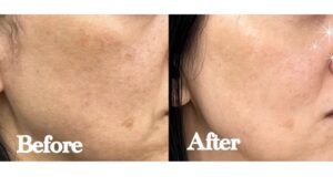 間もなく終了！秋キャンペーン！