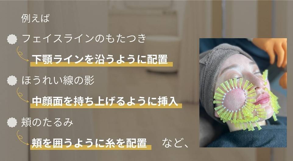 ショッピング感覚でリフトアップしませんか？🥰